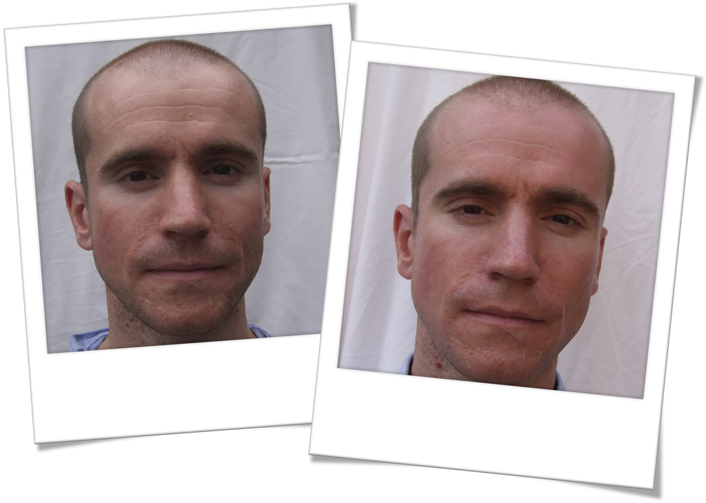 Oliver before and after